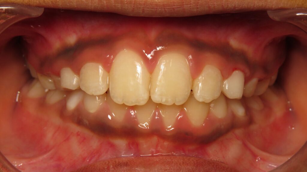 What’s All the Fuss About at Greeley Orthodontics?