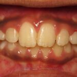 What’s All the Fuss About at Greeley Orthodontics?