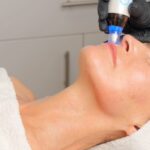 RF Microneedling: The Science, the Benefits, and Why 4 MHz Technology Is Leading the Future of Skin Rejuvenation