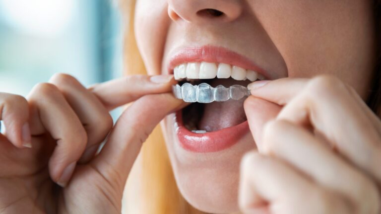 More Than Straight Teeth: How Orthodontic Care Supports Lifelong Oral Health