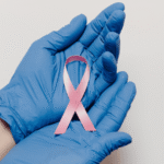 The Hidden Connection Between Skin Cancer and Breast Cancer