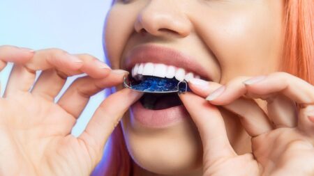 Woman putting in mouth retainer