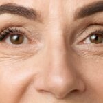 Preventing the Crinkle: A Facial Plastic Surgeon Weighs In