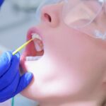 The Fluoride Frontier: Why Your Teeth Deserve This Safe and Sparkly Sidekick