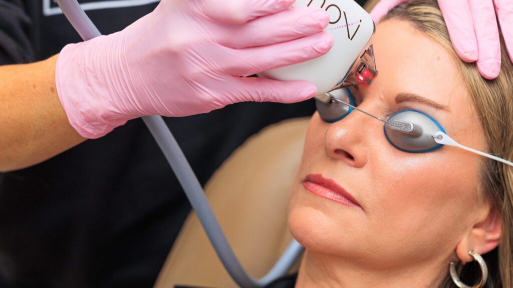 Laser Treatments with 615 Aesthetics