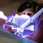 Why Biomimetically Restored Teeth Last Longer and Feel Better
