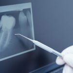 No Pain. No Fear. No Drill!