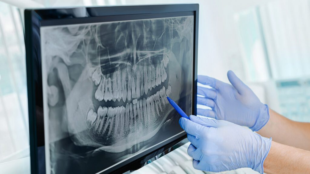 The Role of Technology in Modern Dentistry