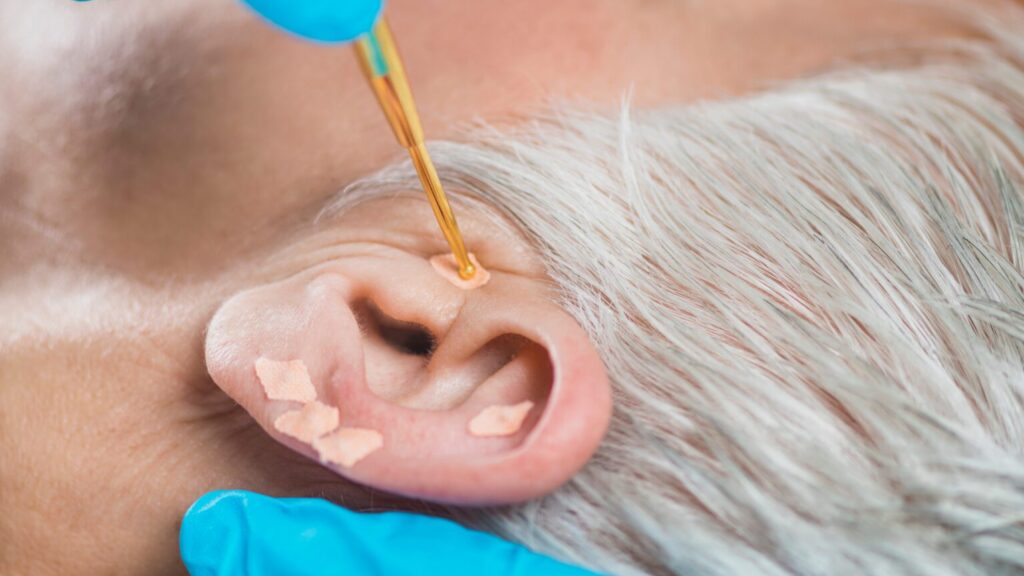 Using Ear Seeds: Support Better Sleep, Weight Balance, and Hormonal Health
