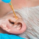 Using Ear Seeds: Support Better Sleep, Weight Balance, and Hormonal Health