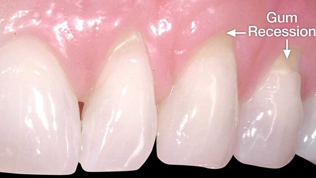 Ask the Dentist: Is it Okay to Drink Carbonated Water?