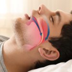 Treating the Airway in Orthodontics: A Key to Better Health