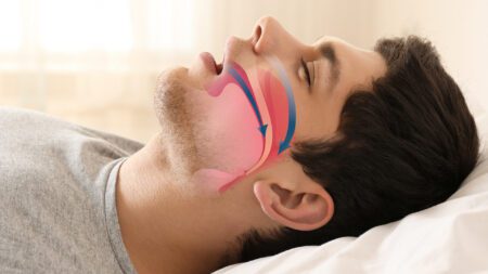 Man with sleep apnea