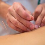 Discover the Benefits of Orthopedic and Sports Medicine Acupuncture