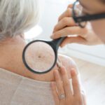 Experience Exceptional Care at Martin Dermatology