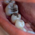 A Beautiful Smile Can Also Be a Healthy Smile