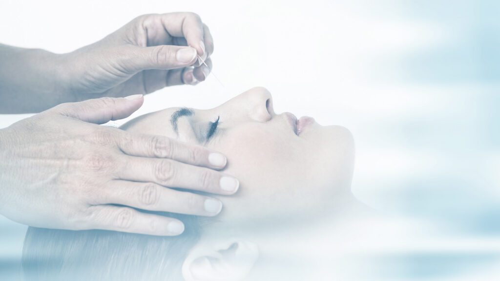 Treating Anxiety With Acupuncture