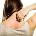 Tips for Dealing With Dry Skin