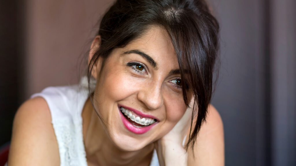 The Benefits of Straightening Your Teeth