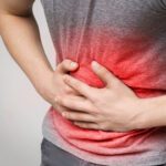 Finding Freedom from Bowel Incontinence
