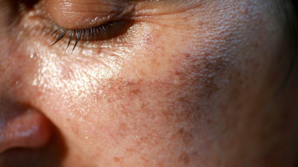Lasers in Medicine: A New Era in Skin Treatment