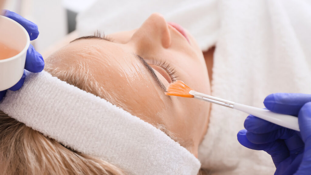 What to Know About Chemical Peels