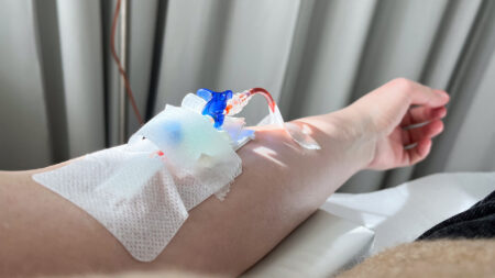 iron infusion blood work