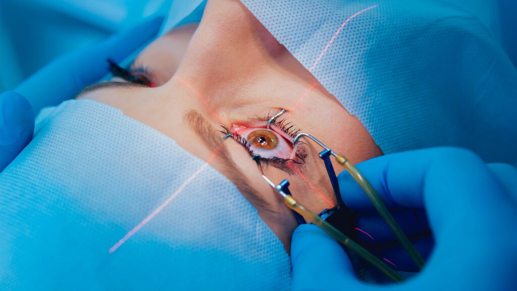 The Future of Clear Sight: The Advantages of Laser-Assisted Cataract Surgery