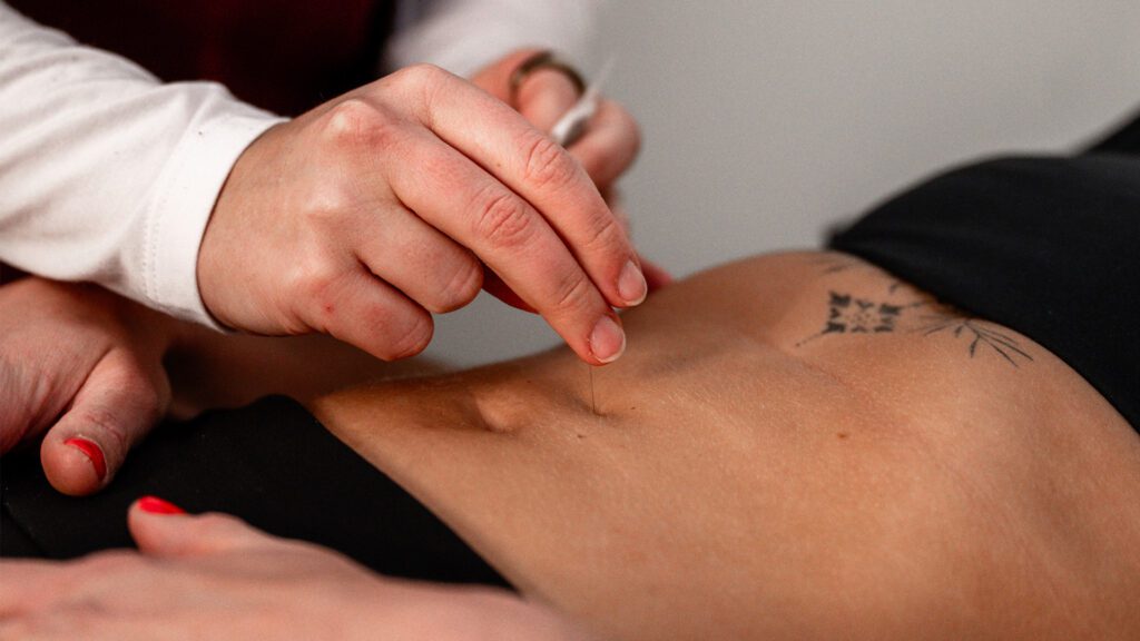Helping Families Grow With Acupuncture
