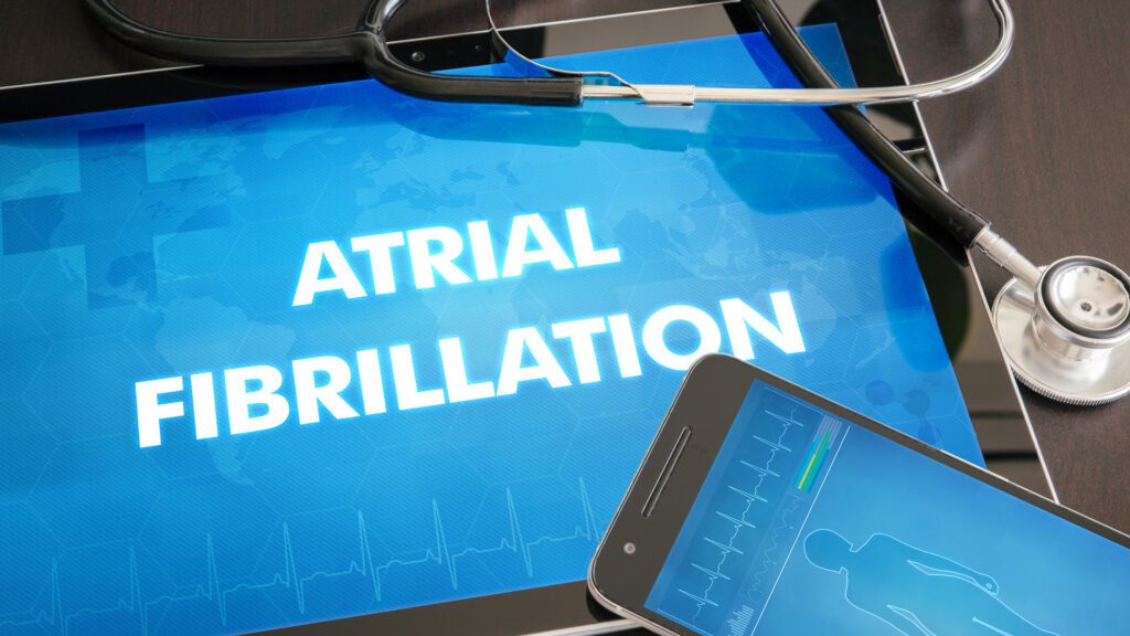 Ask the Expert: What Is Atrial Fibrillation?