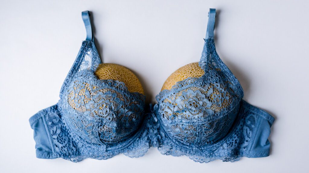 Improving Breast Implant Revision Surgery With the Structural Breast Lift