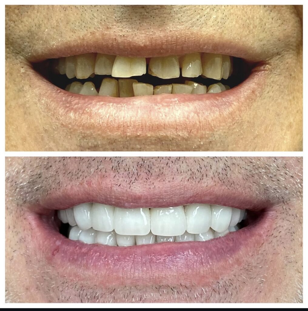 Oral Care is the New Self-Care: 5 Dental Myths Debunked