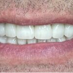 Oral Care is the New Self-Care: 5 Dental Myths Debunked