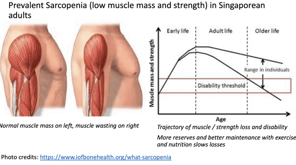 Sarcopenia: The Silent Muscle Loss That Comes With Age – and Why Walking Is Not Enough