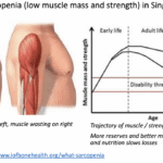 Sarcopenia: The Silent Muscle Loss That Comes With Age – and Why Walking Is Not Enough