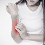 The Stubborn Spot: A Guide to Rashes That Won’t Quit