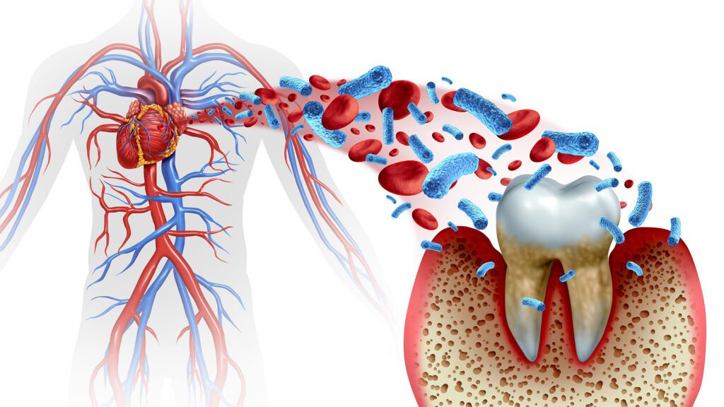 Gum Disease and Heart Disease: What’s the Connection?