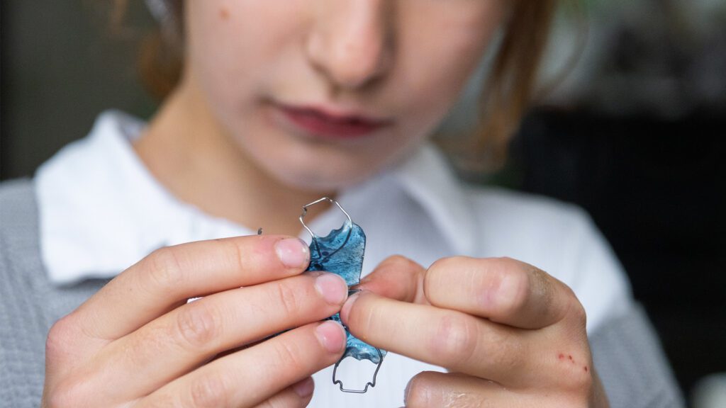Palatal Expanders: What are they, how do they work, and when are they indicated?