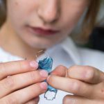 Palatal Expanders: What are they, how do they work, and when are they indicated?