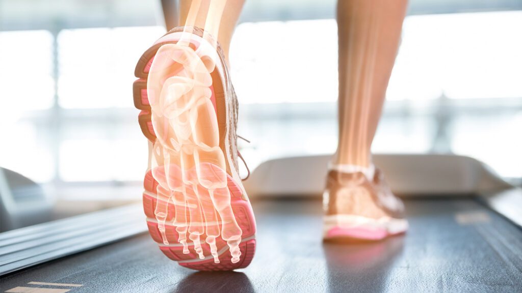 Understanding Plantar Fasciitis: Causes, Relief, and the Right Footwear