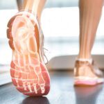 Understanding Plantar Fasciitis: Causes, Relief, and the Right Footwear