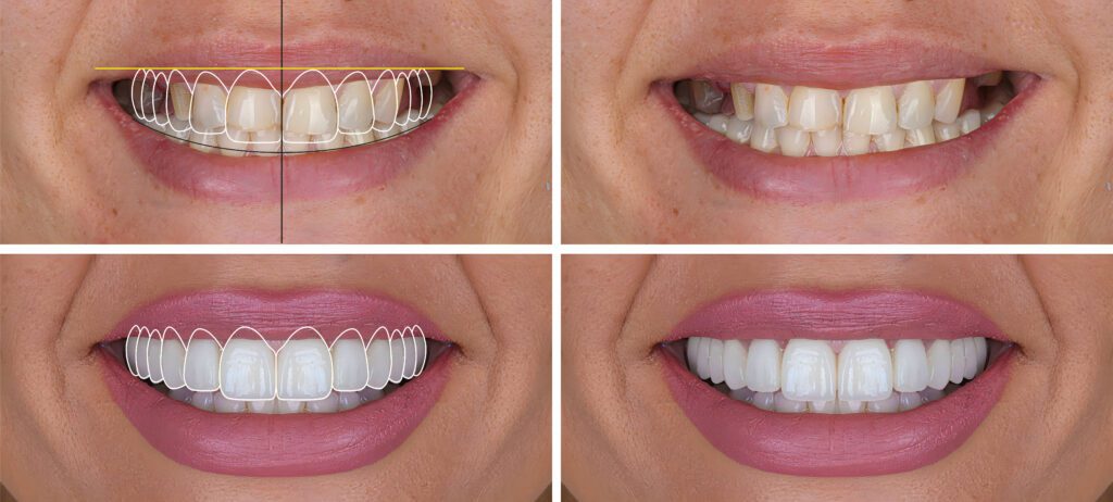 How Cosmetic Dentistry Can Transform Your Summer Smile