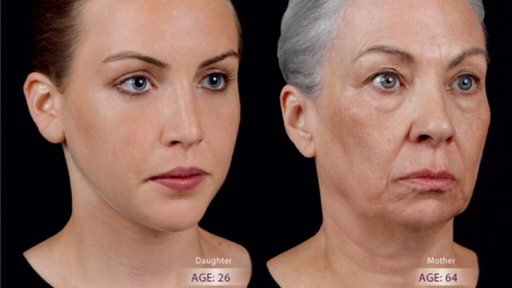 Timeline of Facial Aging