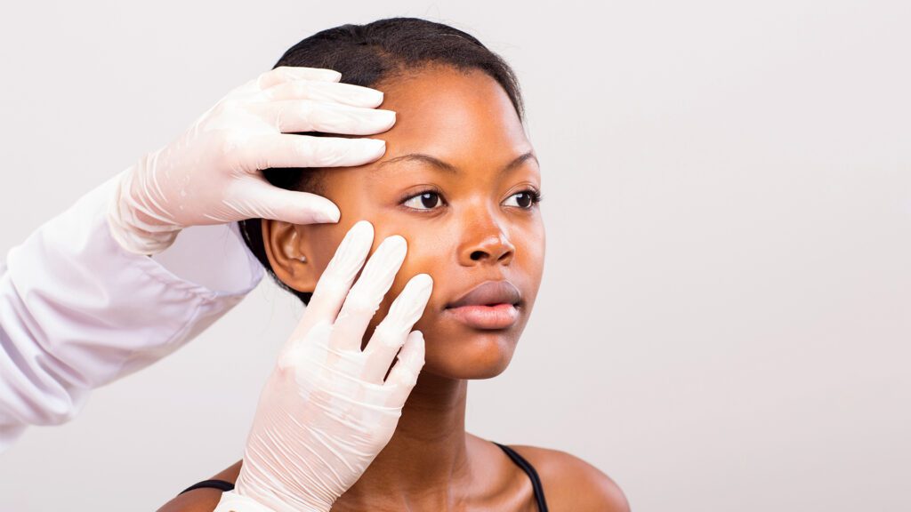 Melasma: What It Is and How We Treat It