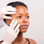 Melasma: What It Is and How We Treat It