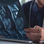 Stronger Bones, Smarter Screening