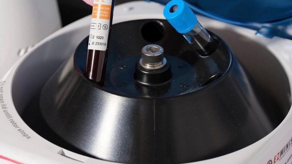 The New Frontier of Bio-Stimulation: Understanding EZ Gel and Plasma Filler