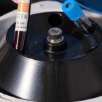 The New Frontier of Bio-Stimulation: Understanding EZ Gel and Plasma Filler
