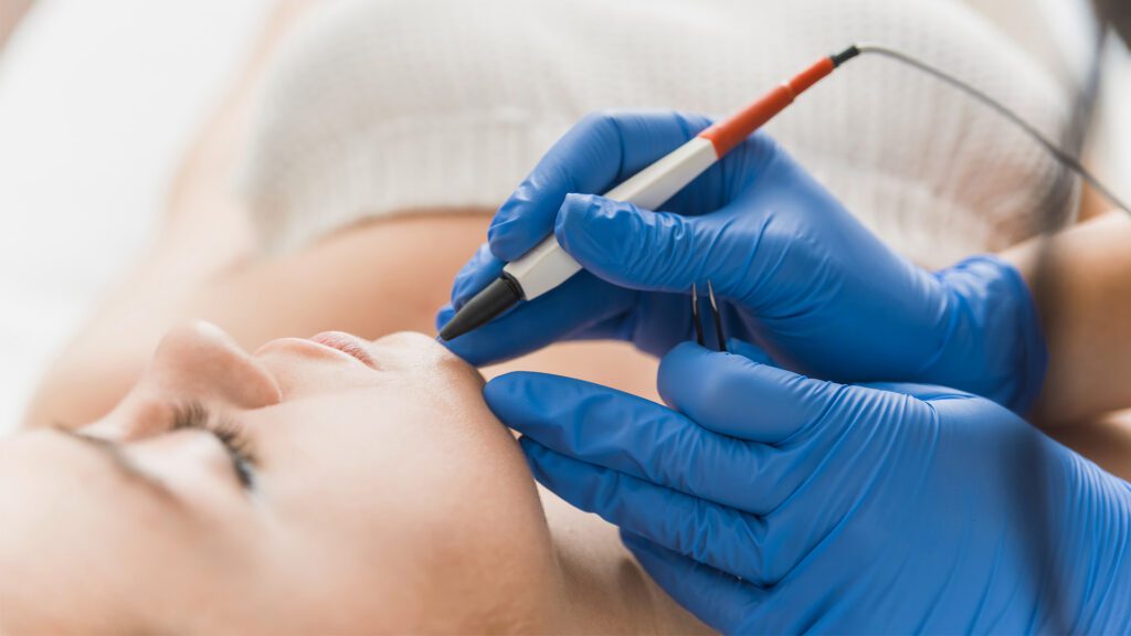 Electrolysis: A Precision Service Offered by On Demand Healthcare