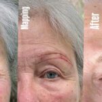 When Brows Disappear: Causes and Solutions to Restore Confidence